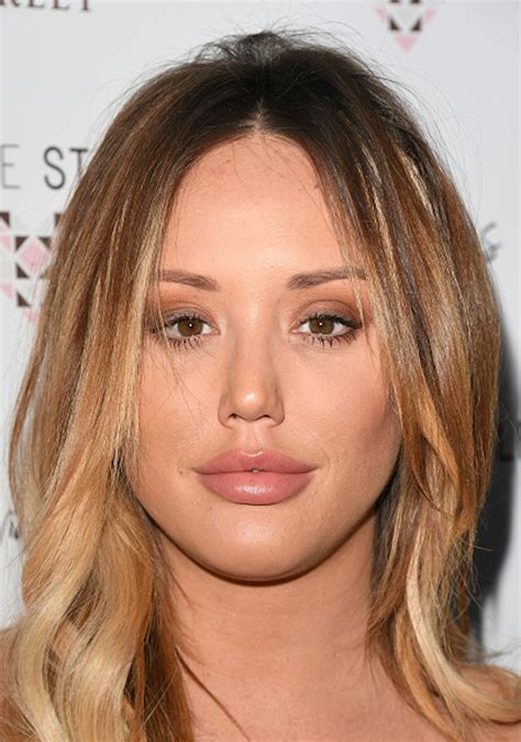 Celebrity lip fillers before and after: A transformation gallery