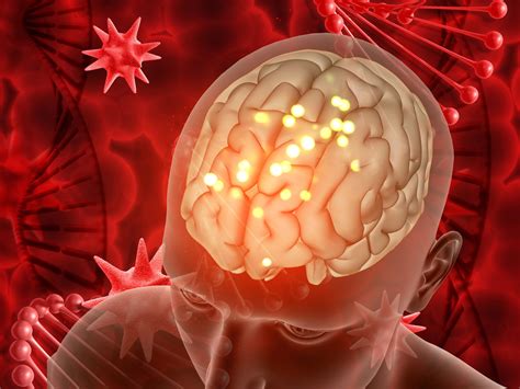 Huntington's Disease Drug Greatly Lowers Chorea Symptoms - eMedNews