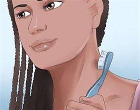 how to get rid of hickeys fast reddit