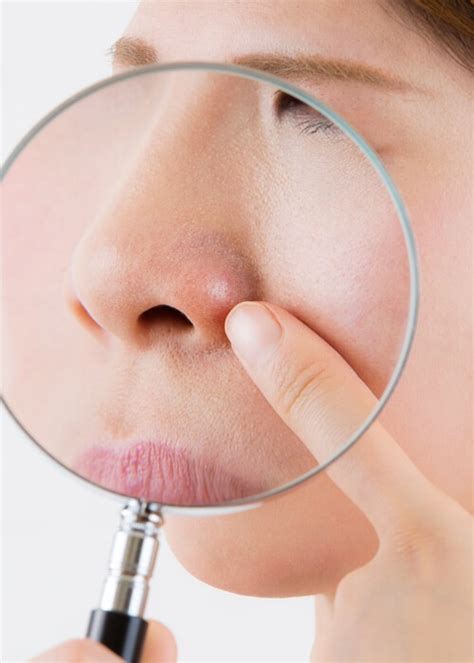 Sebum Nedir?