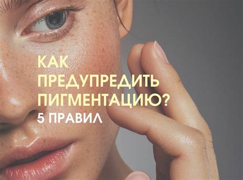 Пигментация: причины и как убрать пигментацию на лице