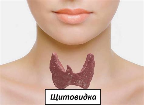 Киста щитовидной железы опасно ли это, симптомы у женщин, лечение