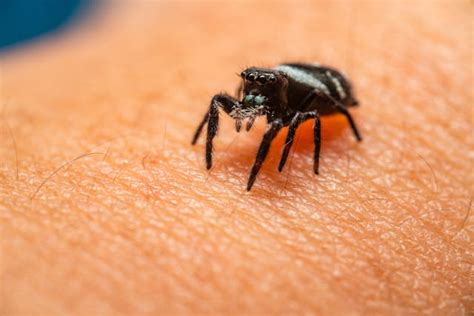 Spider bites first aid | Medibc Blog | MediBC