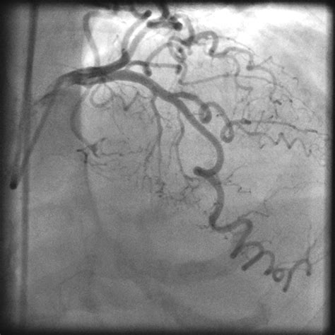 Understanding the underlying causes of tortuous intestines for better health management 25