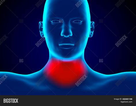 Pharyngitis Infection Image & Photo (Free Trial) | Bigstock