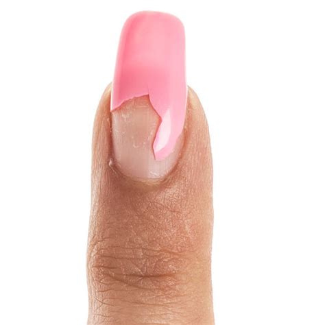 broken fingernail pictures stock  pictures royalty  images