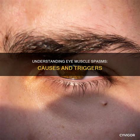understanding eye muscle spasms   triggers cyvigor