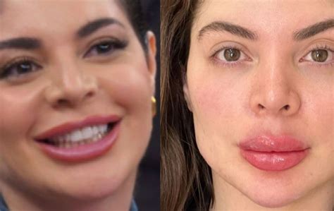 Antes E Depois Da Gkay - Harmonização facial de Gkay tem antes e depois surpreendente! - Purepeople