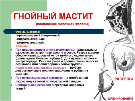 Топографическая анатомия и оперативная хирургия груди - презентация онлайн