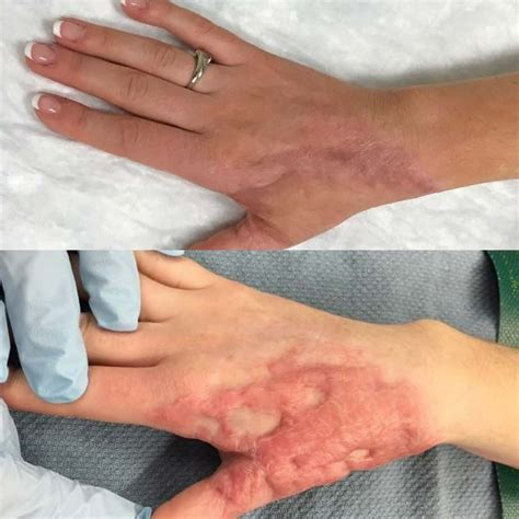 Beyond the Clicks: Katie Sigmond's Lasting Scars After the Leak - ft4wvhv