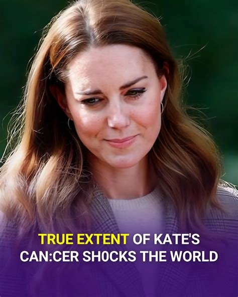 Royal - A sh0cking new revelation about Princess Kate’s gruelling can