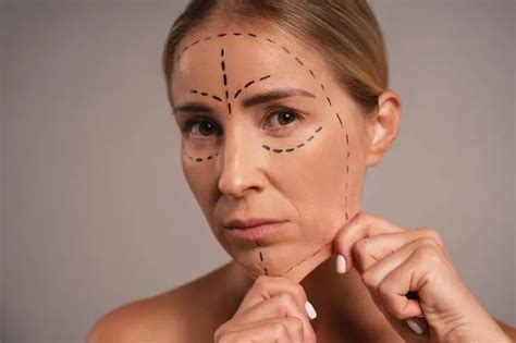 face lifting treatment terbaik  peremajaan wajah