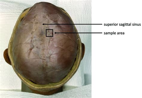 histologic comparison   dura mater  species pmc