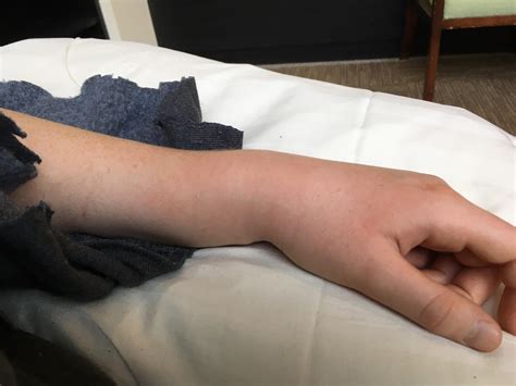 All because my chain fell off... it hearts so freaking bad : r/MTB