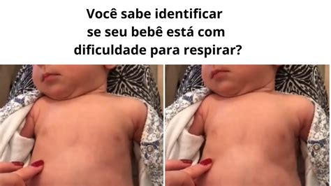 Como Saber Se O Bebe Esta Com Dificuldade Para Respirar - Como identificar se seu bebê está com dificuldade respiratória? - YouTube