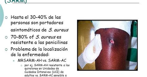 SARM - BACTERIA