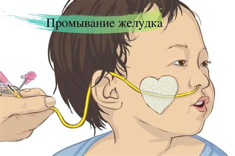 Промывание желудка у детей: показания и алгоритм действий | REW-MED ...