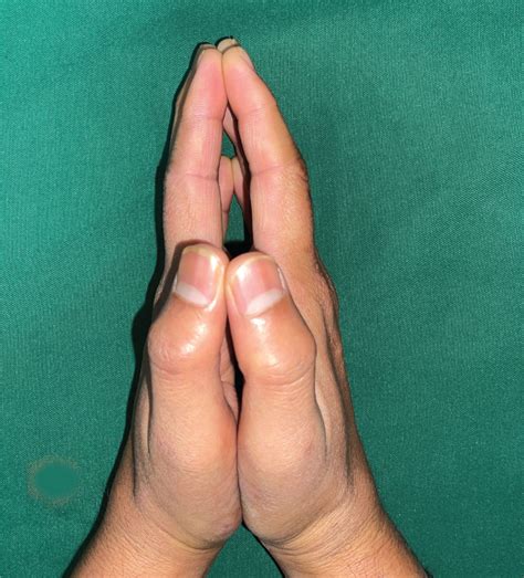 Signs Of Diabetes Your Feet And Diabetes | Diabetes | CDC