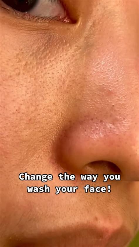 skincare, blackheads | Cilt ipuçları, Cilt tedavisi, Yüz bakımı