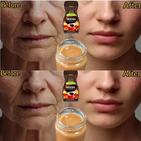 Can Coffee Be More Powerful Than Botox? The Benefits of Coffee for Skin