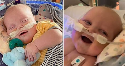 After His Second Open-Heart Surgery, A Baby Boy Smiles For The First ...