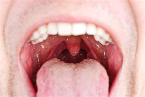 Cancer-causing chemical found in smokeless tobacco | Fox News