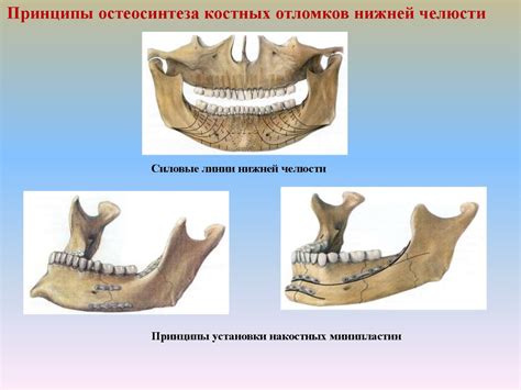 Травмы челюстно-лицевой области - презентация онлайн