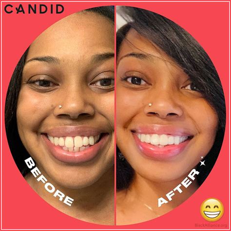 The forum candid io Transformation: Before & After Photos! - g3mzfex