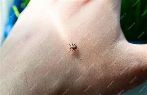 Premium Photo | Infected dangerous biting Tick on human skin