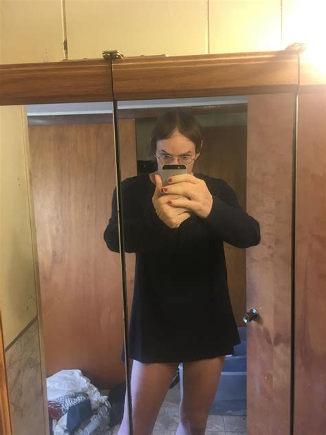 Daily Update from Exploring the Hormonal Route : r/tressless