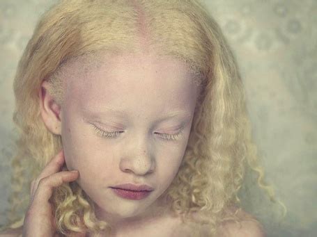 Фото Мужчина альбинос