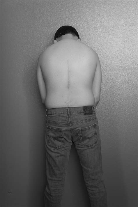 » Scars