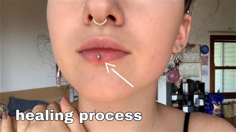 how long does a lip ring take to heal