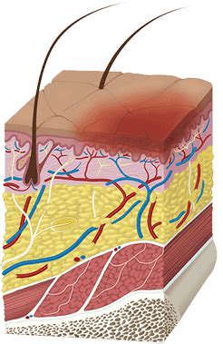 wound research