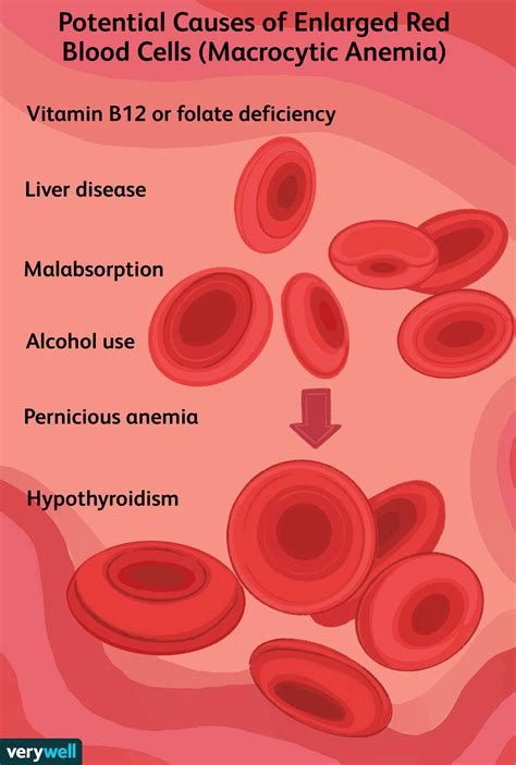 Macrocytic Anemia: Symptoms, Causes, Treatment, and More