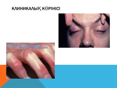 Коллагеноздар биохимиясы - презентация онлайн