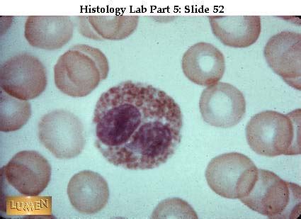 Macrophage Vs Lymphocyte Histology