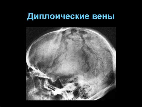 Череп | Портал радиологов