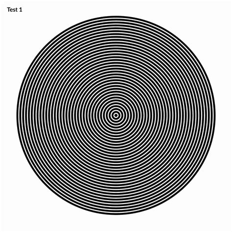 Astigmatism | eyerim blog