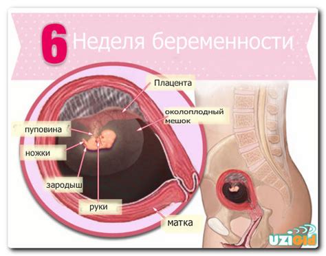 УЗИ 6 акушерских недель беременности,как делают,фото,видео