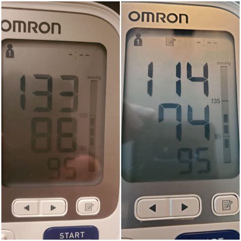 12 best r/fmd images on Pholder | Blood pressure normal after 5 days