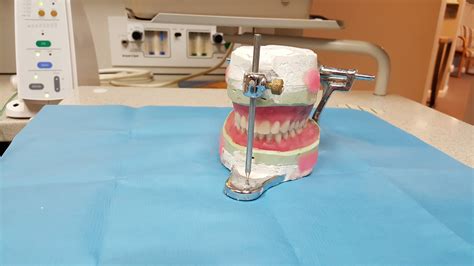 Paradontoza - jej przyczyny i objawy | Dental Diamond