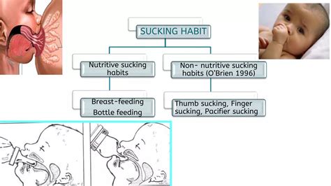 Oral Habits In Children(Thumb Sucking,Tongue Thrusting, Mouth Breathing