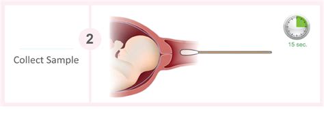 Amniotest step 2 – Women's Health – Obstetrics