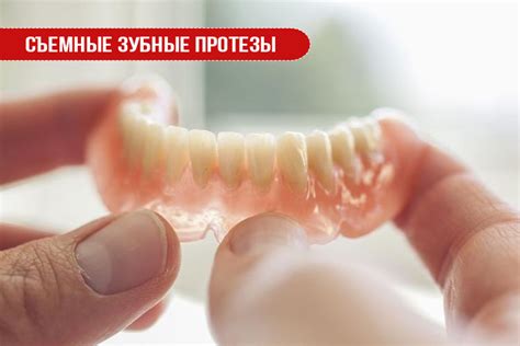 Съемные зубные протезы | Статьи стоматологии в Николаеве