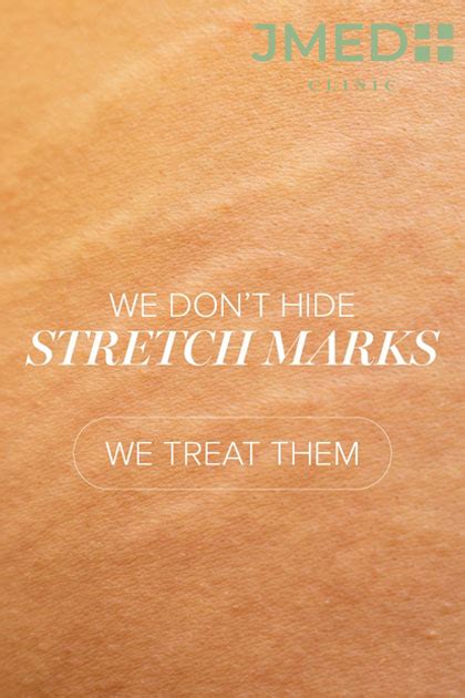 how much does it cost to get stretch marks removed