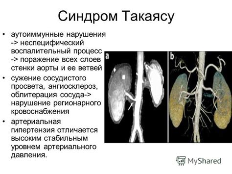 Презентация на тему: "Реноваскулярная артериальная гипертензия ...