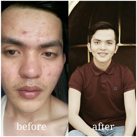 Quitting Smoking Before And After Skin at Clara Garber blog