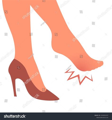 Woman Leg Sore Callus Transverse Flat Stock Vector (Royalty Free