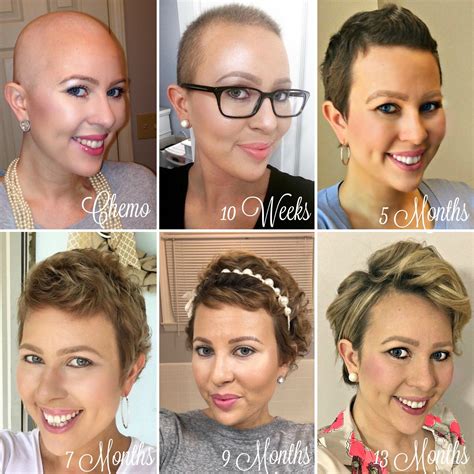 ways to lovebird losing hair step by step 8